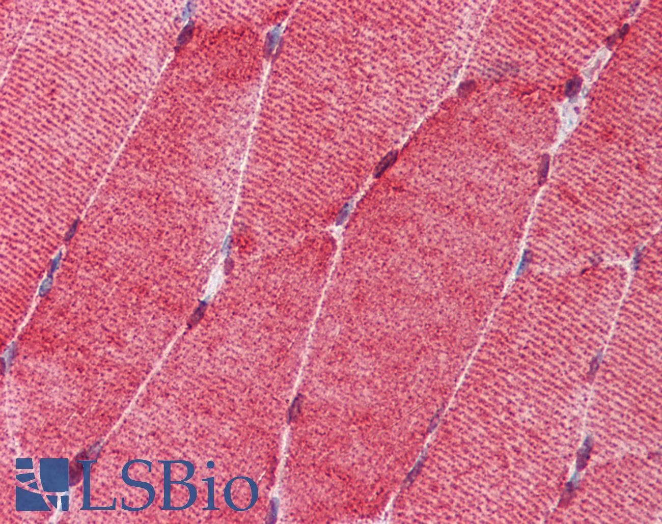 IHC-plus™ HSF1 Antibody (clone 10H8)