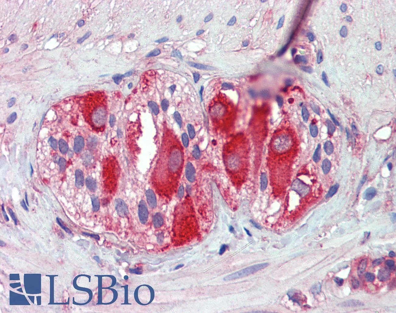 IHC-plus™ MCL1 / MCL 1 Antibody