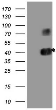 CD40 Antibody (aa21-166, clone OTI8C5, Carrier-free)