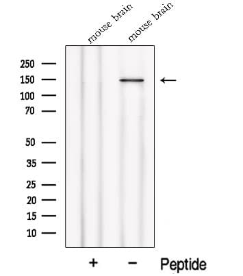 Polyclonal Rabbit anti-Human NPHP4 Antibody (WB)