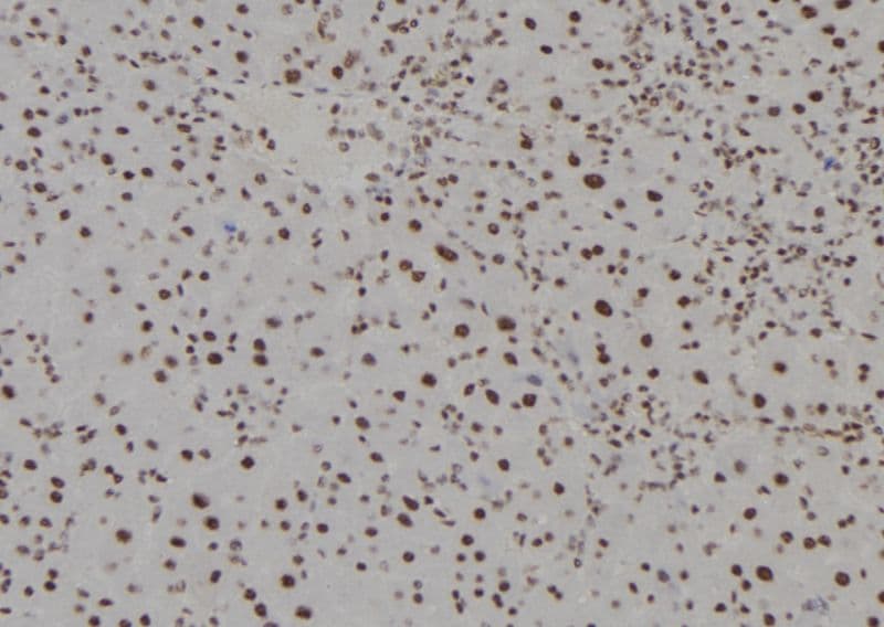 HOXC13 Antibody