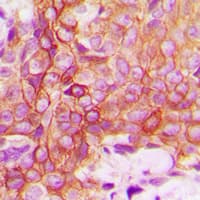 TNFRSF1A / TNFR1 Antibody (C-Terminus)