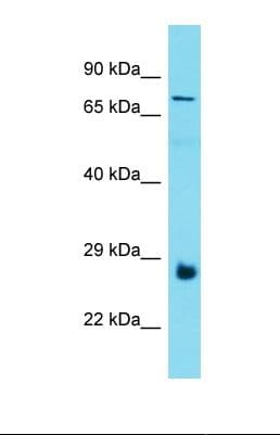 PROSER3 Antibody (aa79-128)