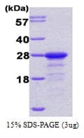 Human PPP1R1A / IPP1 Protein (Recombinant His)