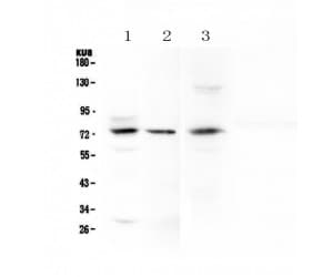 Polyclonal Rabbit anti-Human MAC-2-BP / LGALS3BP Antibody (IHC, WB)