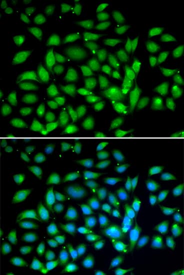 MECP2 Antibody