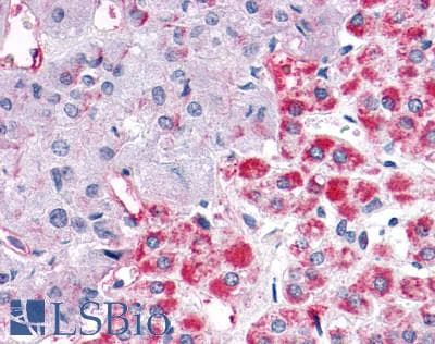 PathPlus™ Polyclonal Rabbit anti-Human GPER1 / GPR30 Antibody (Extracellular Domain, IHC, IF)