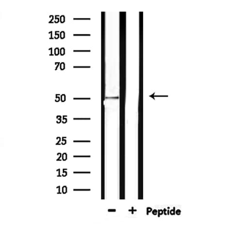 MSR1 / CD204 Antibody