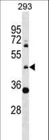 ZNF2 Antibody (aa80-106)