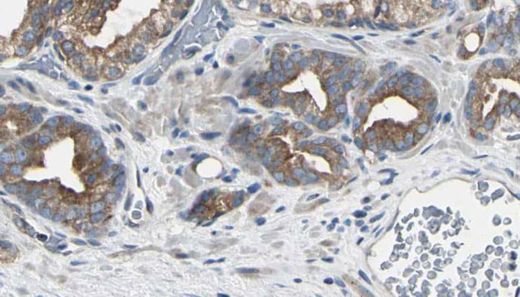 RPL22L1 Antibody