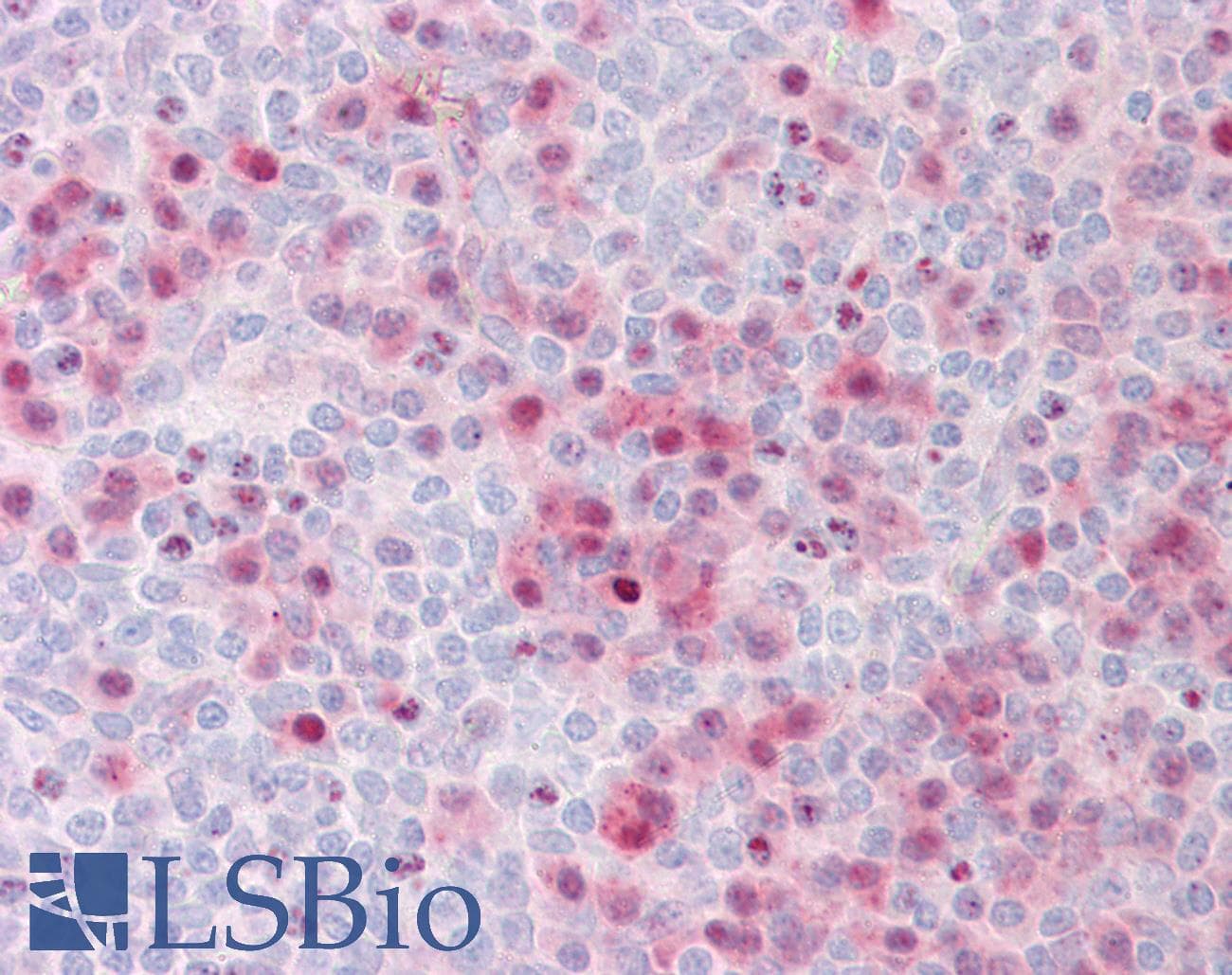 IHC-plus™ BRAF / B-Raf Antibody (aa171-220)
