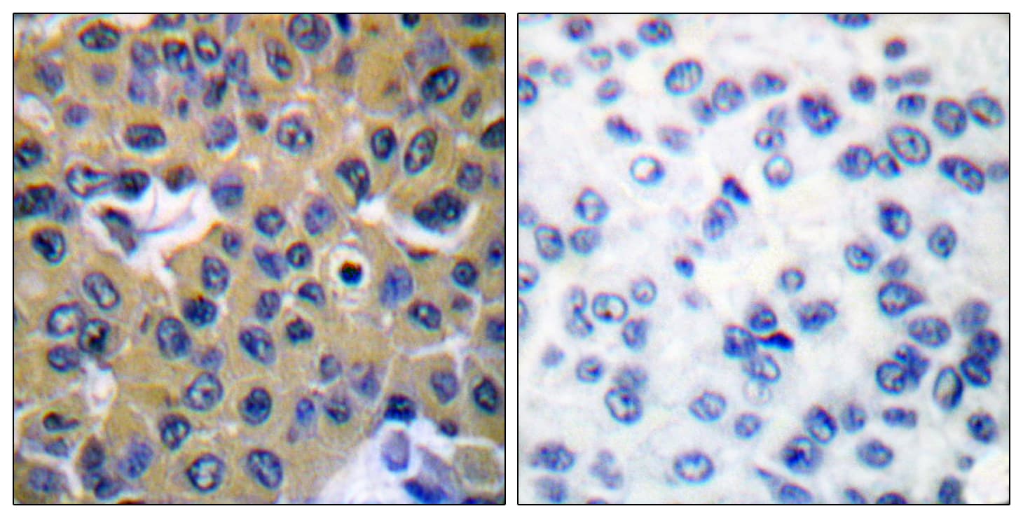 Polyclonal Rabbit anti-Human PTPN11 / SHP-2 / NS1 Antibody (phospho-Tyr542, IHC, WB)