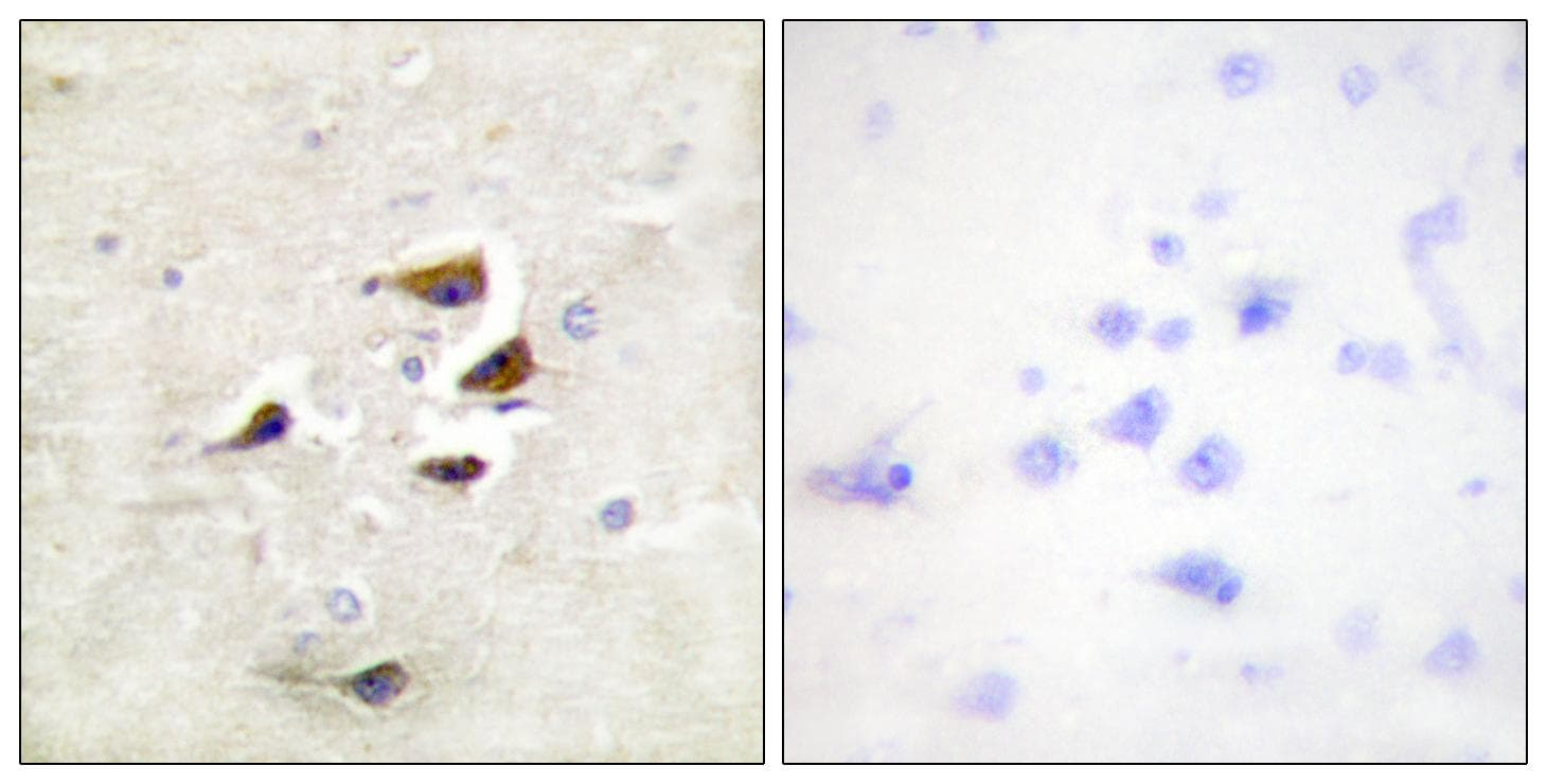 CaMKII Alpha+Beta+Delta Antibody (Ab-305)