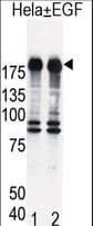 IHC-plus™ Polyclonal Rabbit anti-Human EGFR Antibody (Ser1070, IHC, WB)
