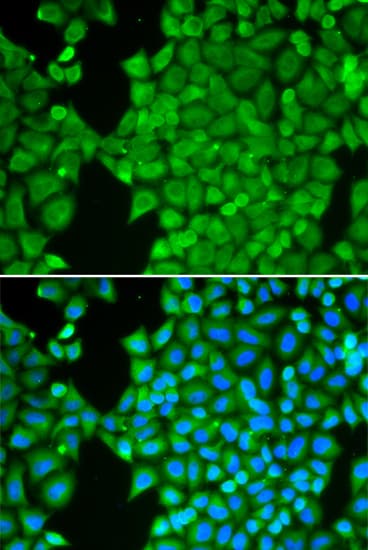 Polyclonal Rabbit anti-Human CA3 / Carbonic Anhydrase III Antibody (IHC, IF, WB)