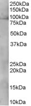 IHC-plus™ Polyclonal Goat anti-Human XAB2 Antibody (aa843-855, IHC, WB)