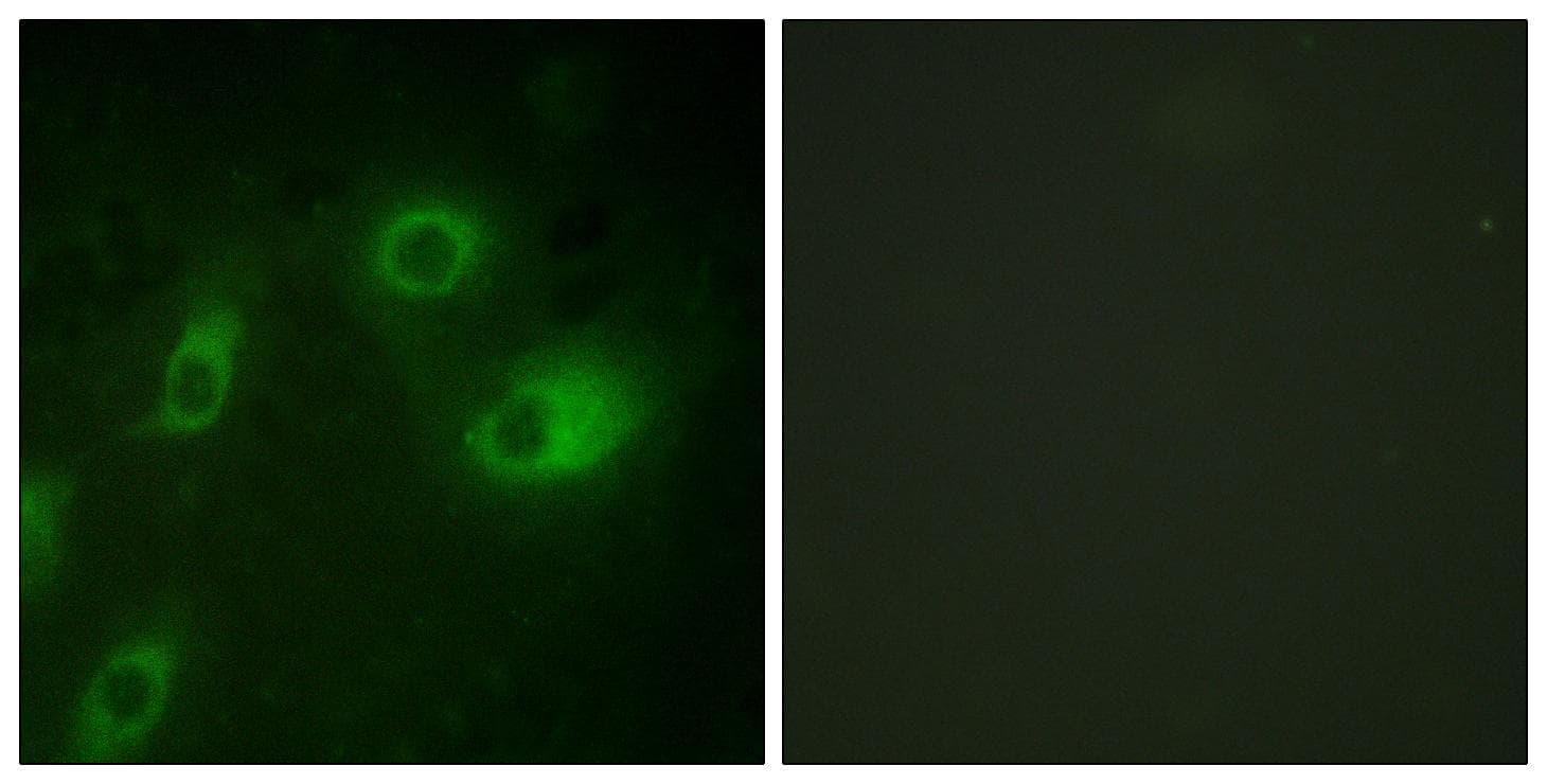 KRT18 / CK18 / Cytokeratin 18 Antibody (phospho-Ser52)