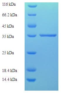 Human ZMAT5 Protein (Recombinant His-SUMO)