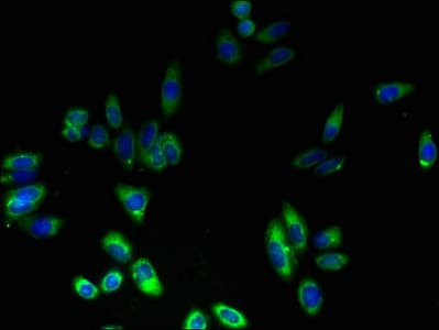 Polyclonal Rabbit anti-Human FAD104 / FNDC3B Antibody (IHC)