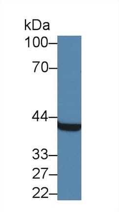 APOE / Apolipoprotein E Antibody (aa1-172)