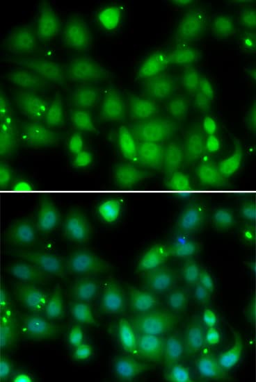 RORA / ROR Alpha Antibody