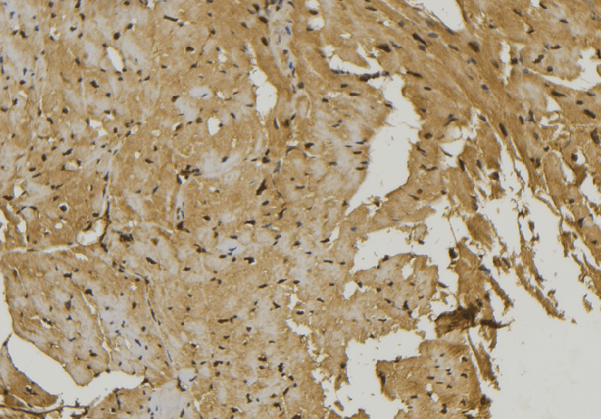 Polyclonal Rabbit anti-Human S1PR1 / EDG1 / S1P1 Antibody (IHC, WB)
