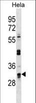 UTP11L Antibody (aa227-253)
