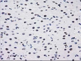 MEF2C Antibody (clone OTI2D2)