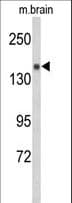 SEMA5A / Semaphorin 5A Antibody (Ser106)