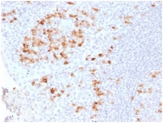 Kappa Light Chain Antibody (clone KLC2289R)