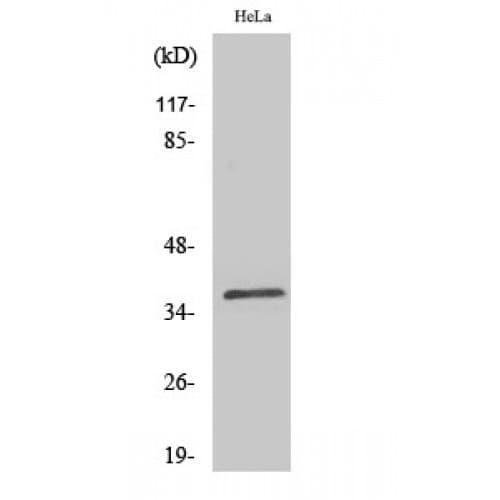 Polyclonal Rabbit anti-Human GIMAP4 Antibody (100-180 aa, Internal, IHC, WB)