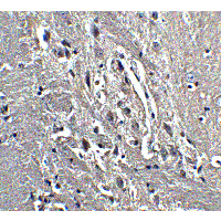 Polyclonal Rabbit anti-Human Kinesin 5A / KIF5A Antibody (IHC, IF, WB)