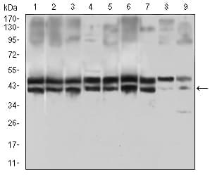 IL2RA / CD25 Antibody (aa34-139, clone 1B5D12)