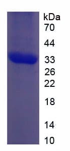 Human NOTCH2 Protein (Recombinant His, N-Terminal)