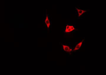 LGALS1 / Galectin 1 Antibody
