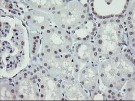 ZBED1 / TRAMP Antibody (clone OTI5A2)