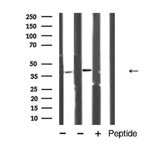 CASP4 / Caspase 4 Antibody