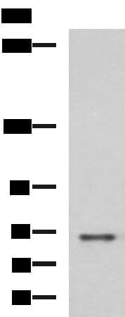 PREPL Antibody