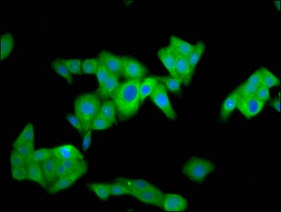 Polyclonal Rabbit anti-Human NUMBLIKE / NUMBL Antibody (IHC, IF)