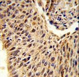 Polyclonal Rabbit anti-Human GLIS1 Antibody (aa133-161, IHC, WB)