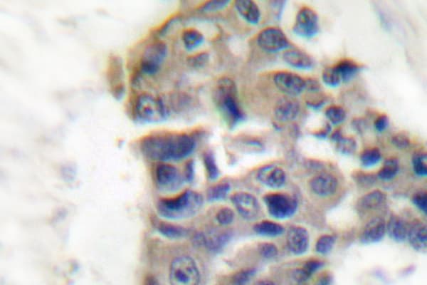 SYT1 / Synaptotagmin Antibody (Thr196)