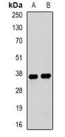 IHC-plus™ Polyclonal Rabbit anti-Human TPM3 Antibody (IHC, IF, WB)