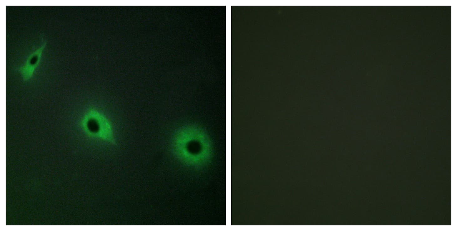 CELSR3 Antibody (aa91-140)