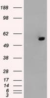 ATP5B / ATP Synthase Beta Antibody (clone OTI9E3, Carrier-free)
