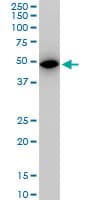 IHC-plus™ ALDOA / Aldolase A Antibody (clone 2E6)