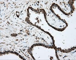 PRKAR2A Antibody (clone OTI1C4)