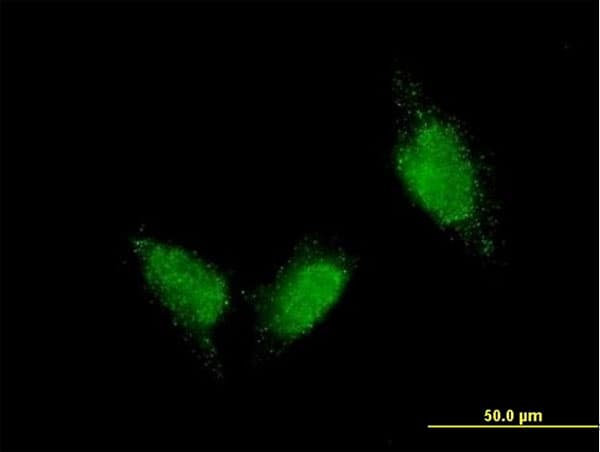 Monoclonal Mouse anti-Human TTN / Titin Antibody (clone 7D3, IF, WB)