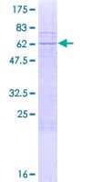 Human Myozenin / MYOZ1 Protein (Recombinant GST)