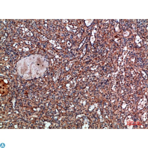 Polyclonal Rabbit anti-Human HLA-DQA1 Antibody (IHC)
