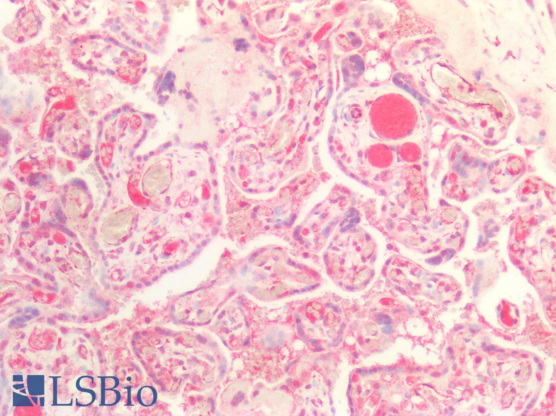 IHC-plus™ Polyclonal Rabbit anti-Human ATXN2 / SCA2 / Ataxin-2 Antibody (aa721-780, IHC, WB)